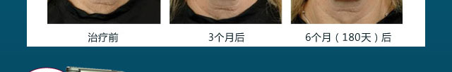 重庆热玛吉