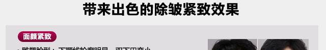 热玛吉除皱紧致效果